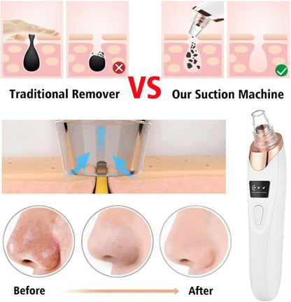 2024 Blackhead Remover Pore Vacuum,Facial Pore Cleaner-5 Suction Power,5 Probes,USB Rechargeable Blackhead Vacuum Kit Electric Acne Extractor Tool for Adult (White)