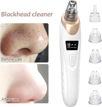 2024 Blackhead Remover Pore Vacuum,Facial Pore Cleaner-5 Suction Power,5 Probes,USB Rechargeable Blackhead Vacuum Kit Electric Acne Extractor Tool for Adult (White)