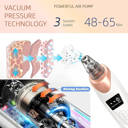 2024 Blackhead Remover Pore Vacuum,Facial Pore Cleaner-5 Suction Power,5 Probes,USB Rechargeable Blackhead Vacuum Kit Electric Acne Extractor Tool for Adult (White)